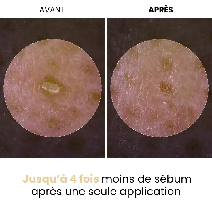 Kynae - Éclat de Riz